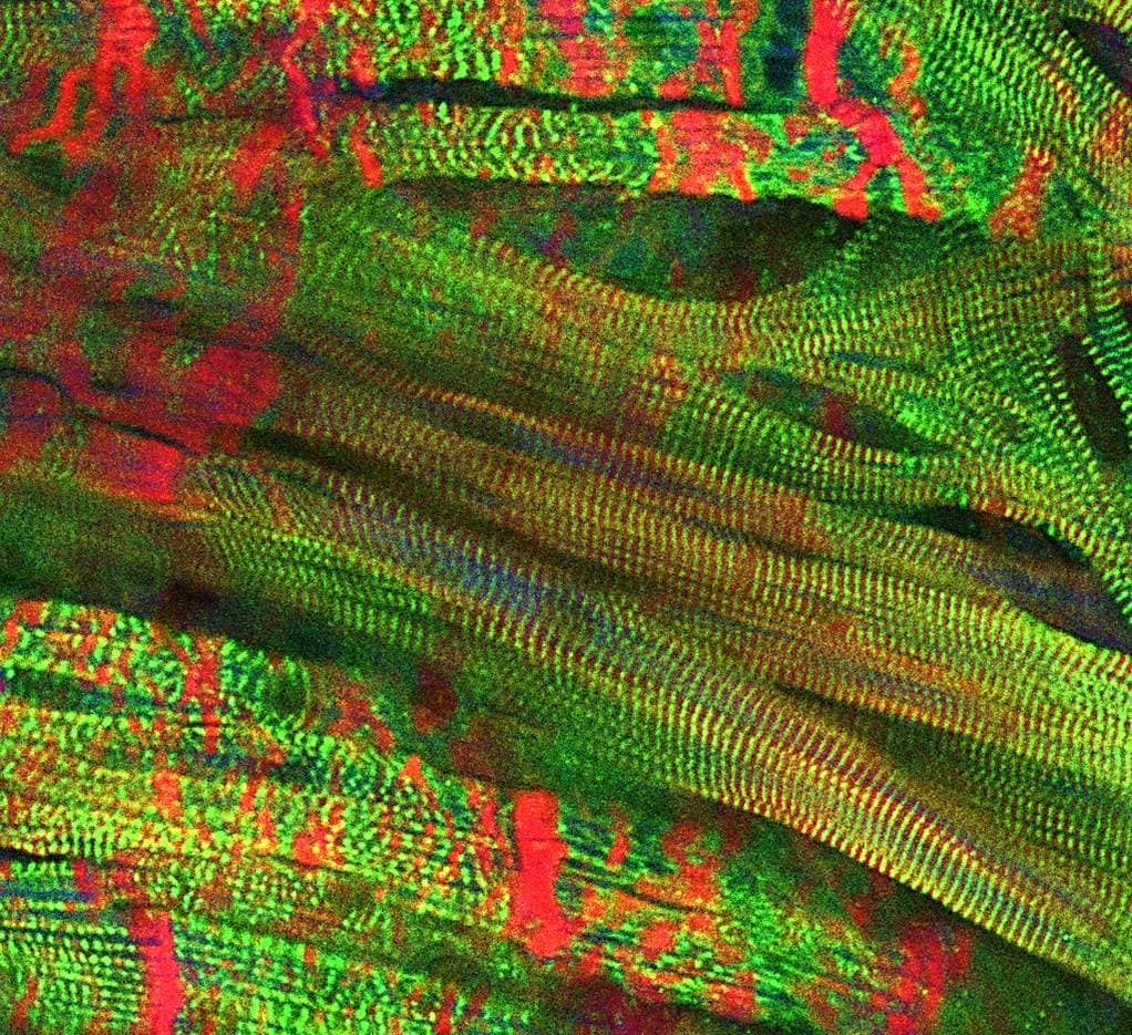 Human Cardiac Tissue Chip (47473708501)