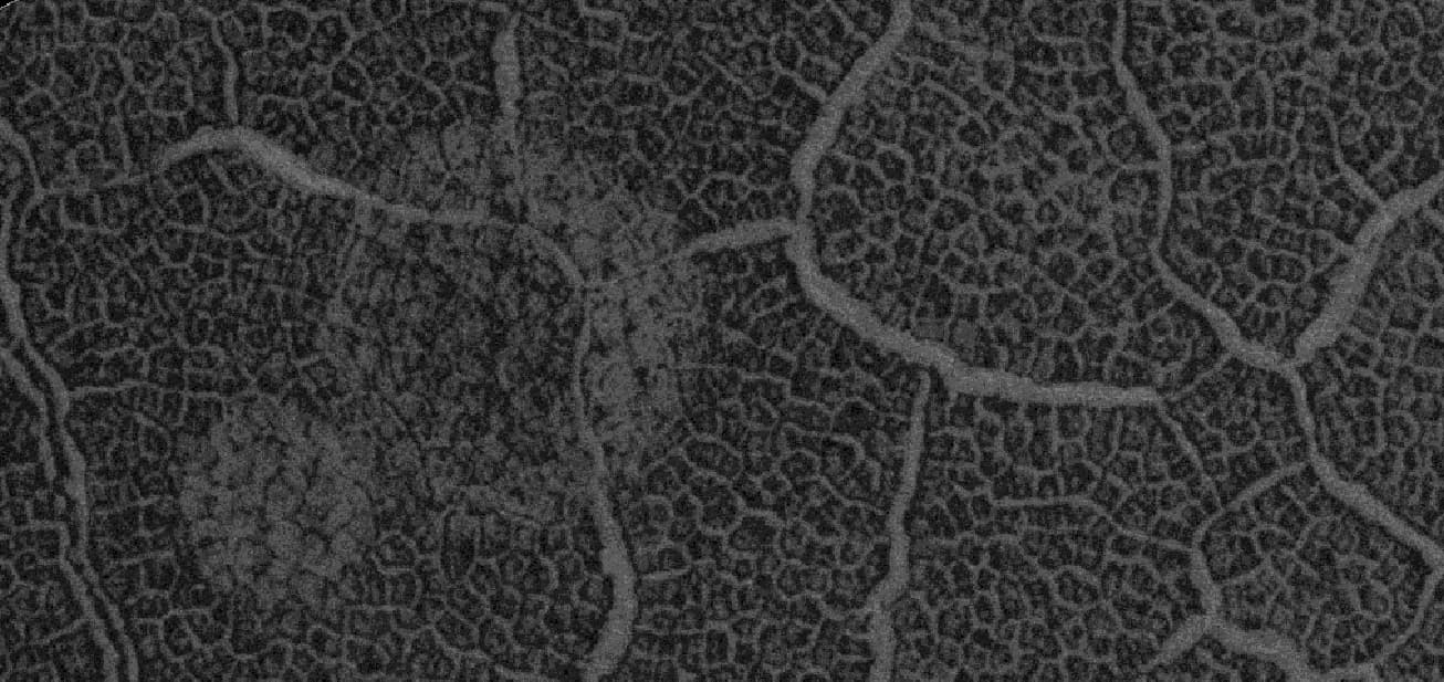 56148 1145polygonsveryclosecircles
