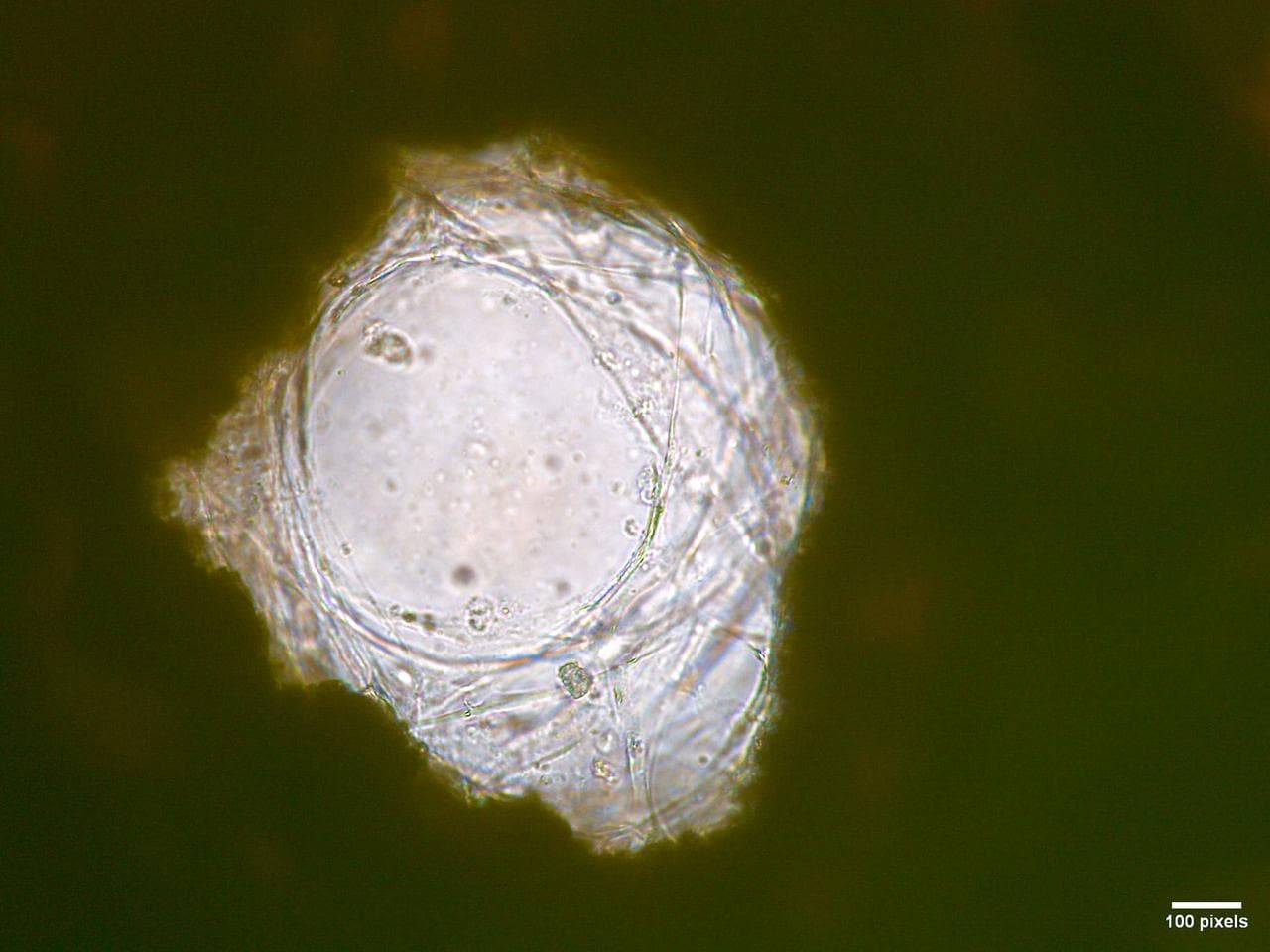 March, microscopic, human