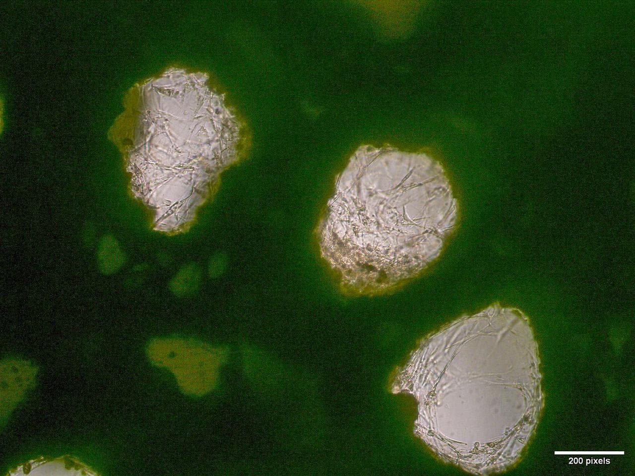 March, microscopic, human