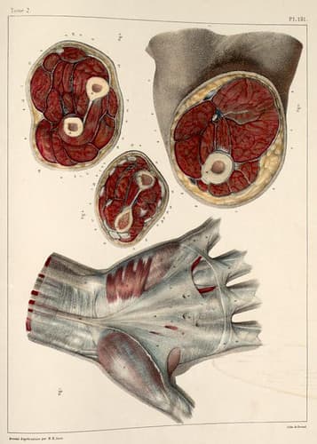 43 - Bones and muscles of the arm in cross-section; fascia of the hand