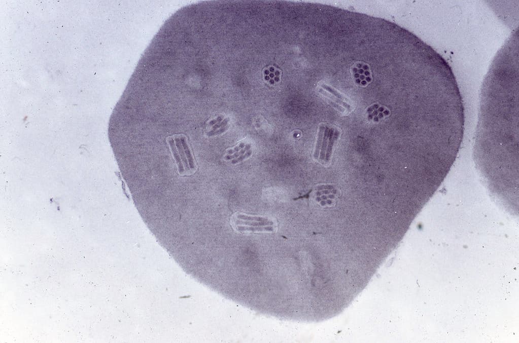 Biocontrol, electronmicroscope, forestentomology