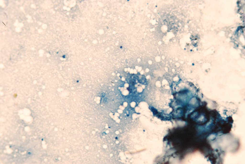 Forestentomology, foresthealth, forestinsect