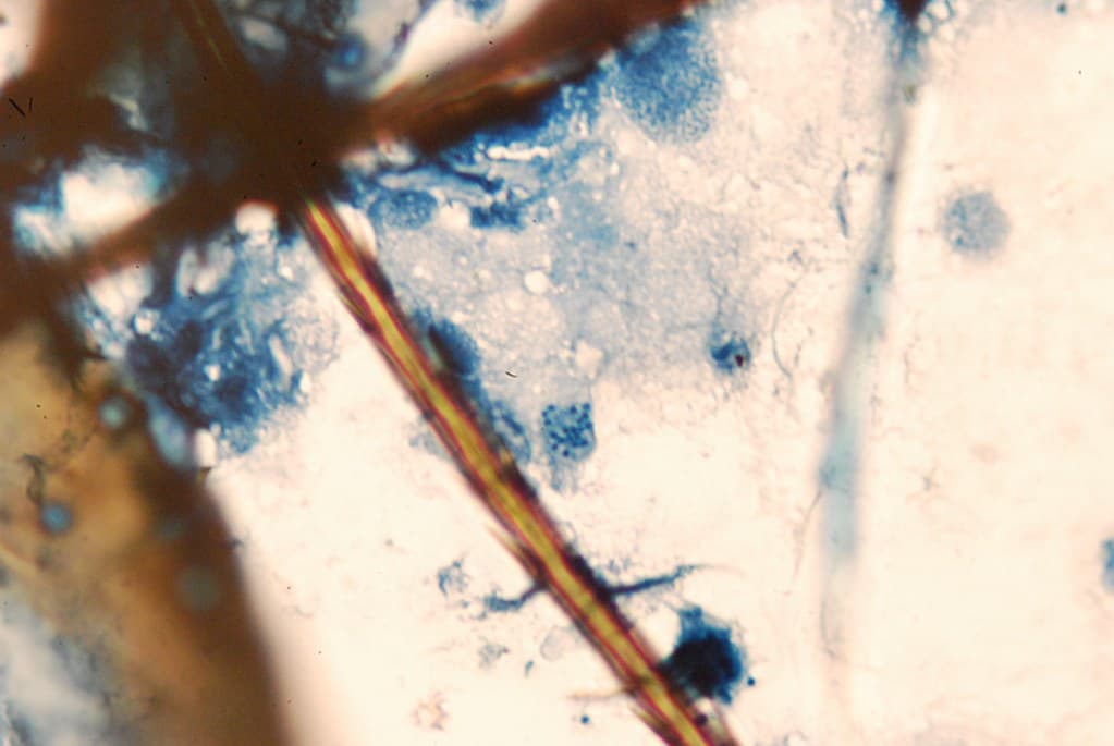 Forestentomology, foresthealth, forestinsect