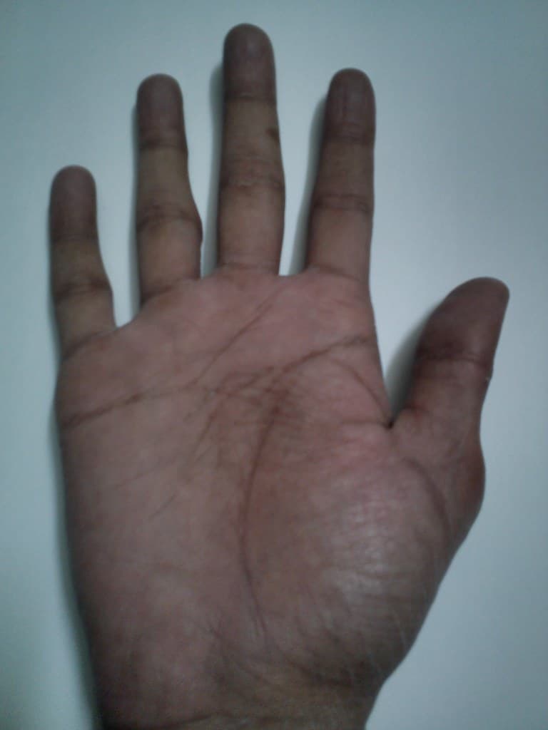 Palmar human right hand