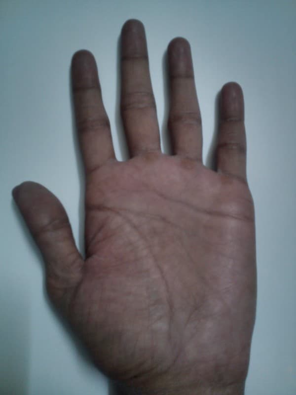 Palmar human left hand