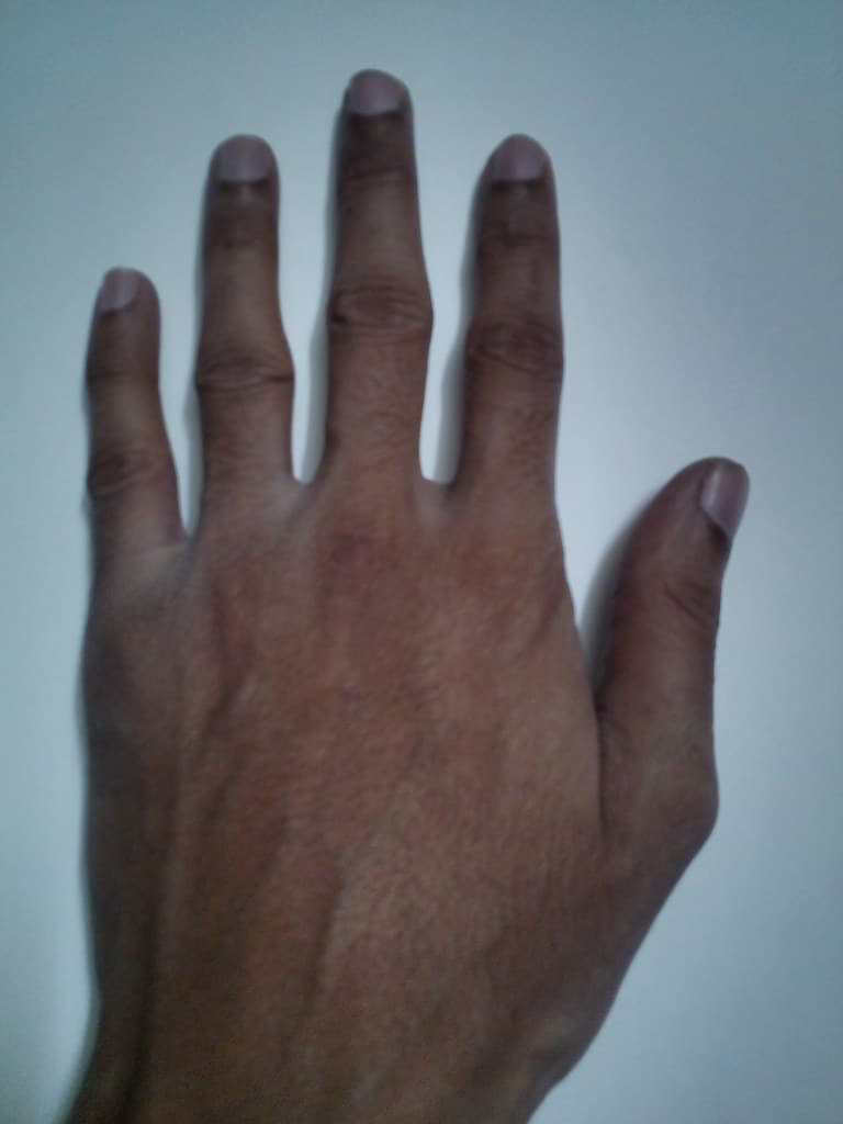 Opisthenar area human left hand