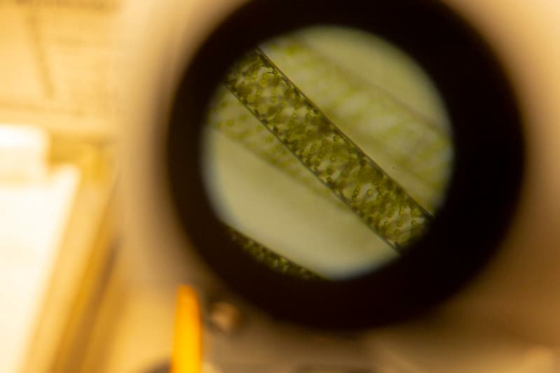 Pond Management Water Sample Algae Under Microscope