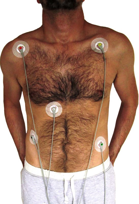 Heart Monitor