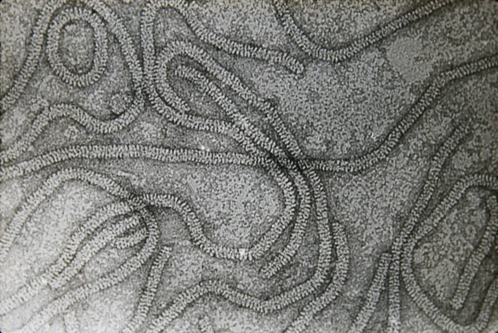 Citrus tristeza: transmision electron micrograph of CTV particles