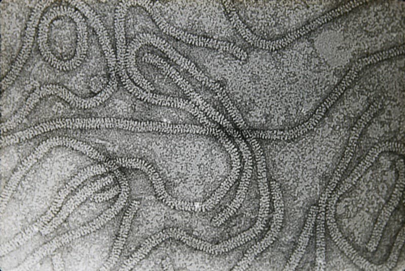 Citrus tristeza: transmision electron micrograph of CTV particles
