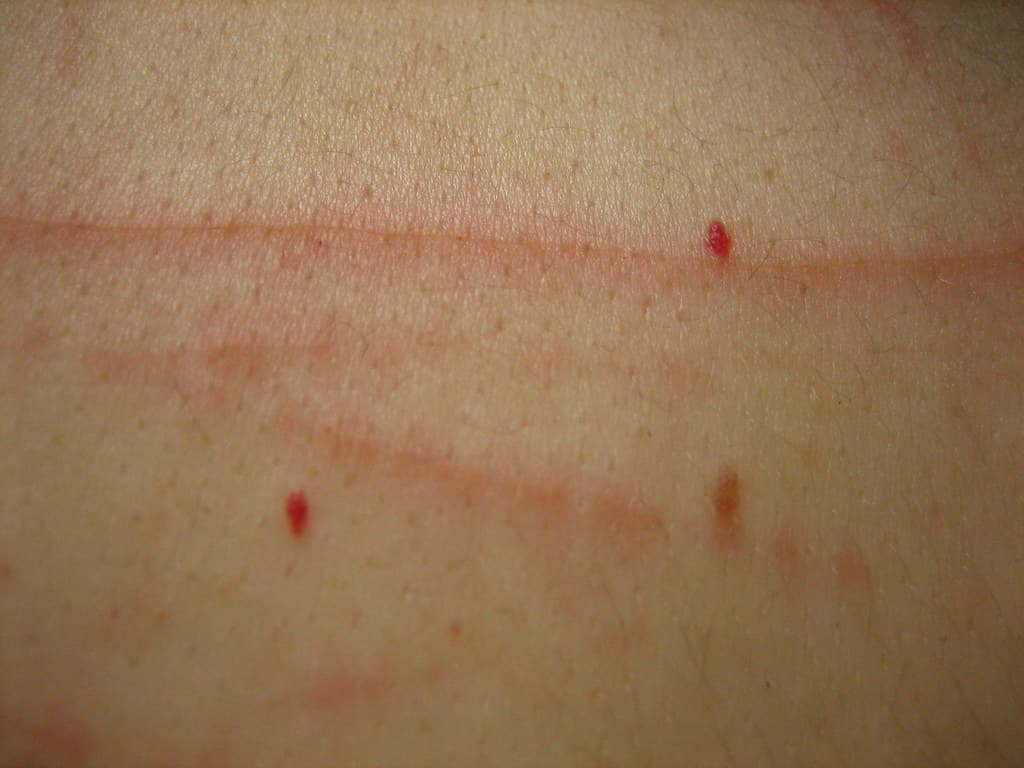 Scratched Skin Texture