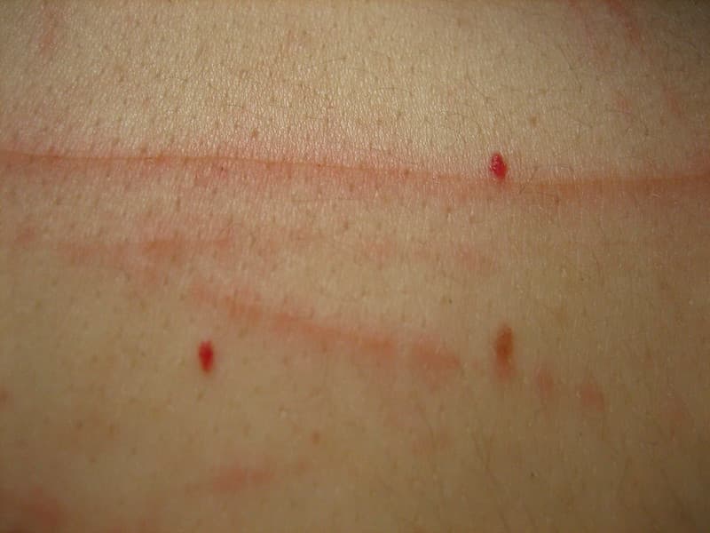 Scratched Skin Texture
