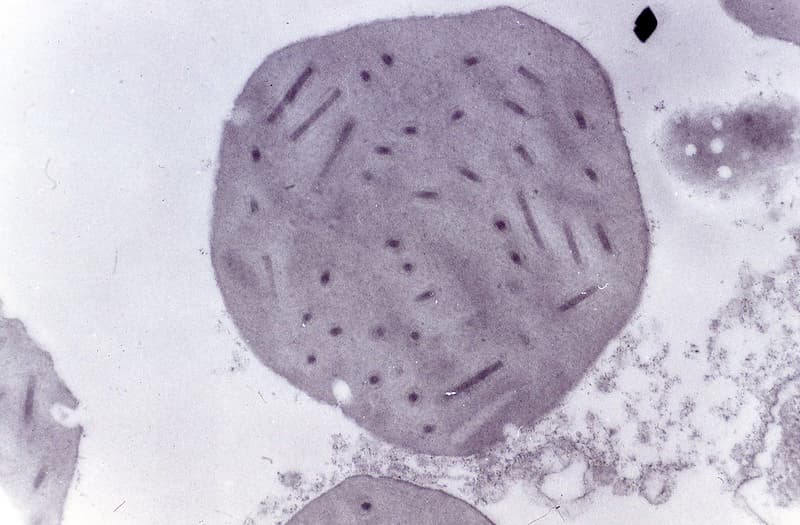 Biocontrol, electronmicroscope, forestentomology