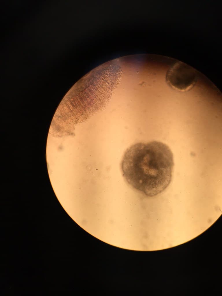 Parasite Under a Microscope